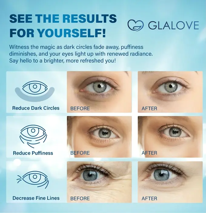 Under-Eye Pads to Swollen Under-Eyes, Sixty Pieces Collagen Pads Treatment