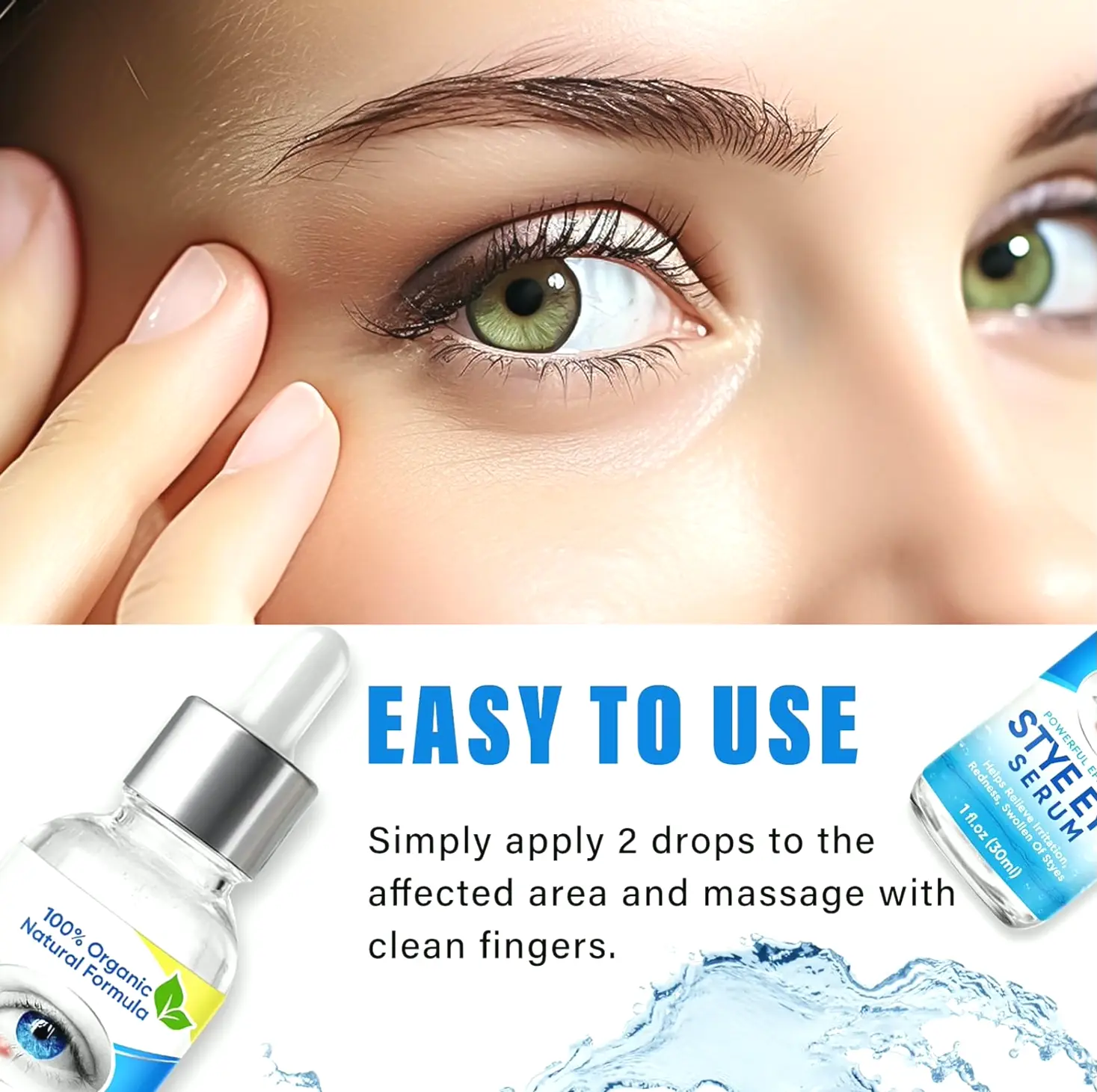 Chalazion Vision Treatment Drops for Quick Efficacy
