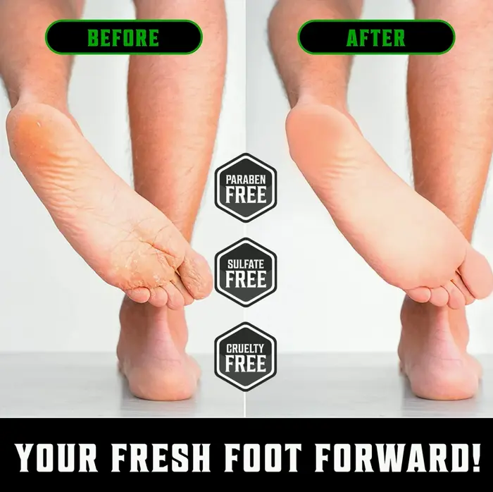 Tea Tree Feet Cream for Dry Heels with Mint (8oz)